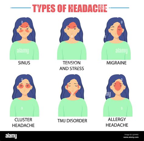 Diferentes Tipos De Dolores De Cabeza Vectores Ilustraciones Conjunto