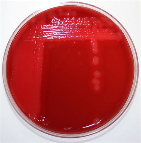 Flickriver Most Interesting Photos Tagged With Hemolysis