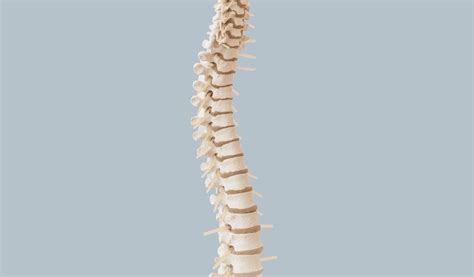 Unravelling Lordotic Postures Implications And Interventions In