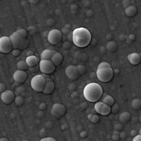 Sem Surface Morphology Of Electroless Ni P Deposit A Before And B