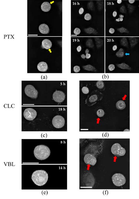 Snapshot Of Sw Cells Treated With Microtubule Targeting Drugs Ptx