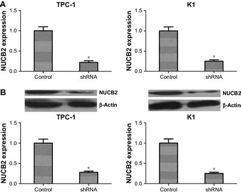 Knocking Down Of Nucb By Shrna In Both Tpc And K Cells Notes