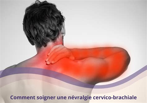 SOIGNER LA NÉVRALGIE CERVICO BRACHIALE le plan d action imparable