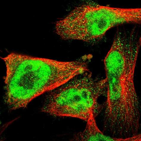 Zmynd11 Antibodies The Human Protein Atlas