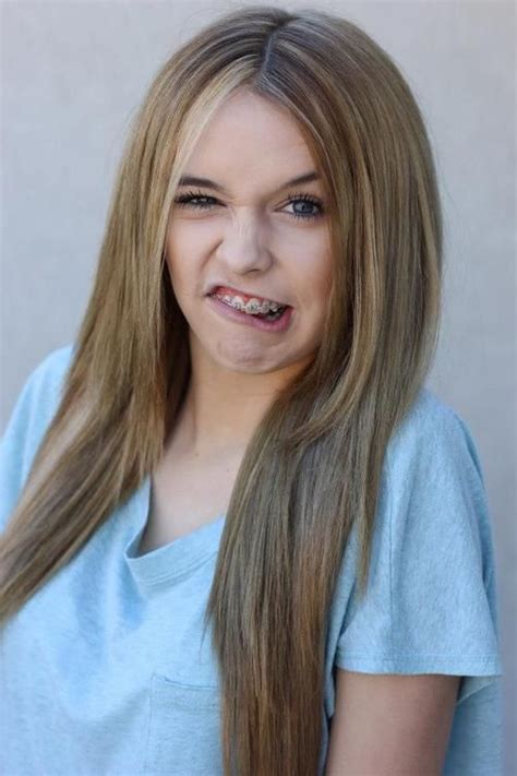 Acacia Clark Braces