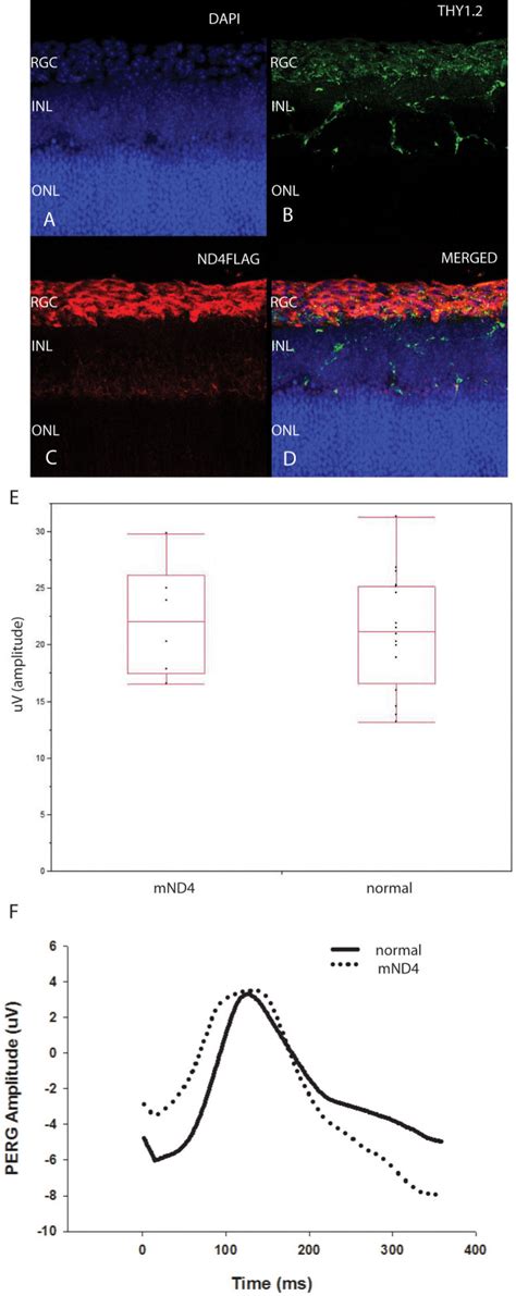 Wild Type Human Nd4 Expression In Rgcs Does Not Cause Visual Loss In