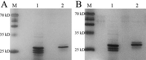 Affinity Purification Of A Fibrinolytic Enzyme From Sipunculus Nudus