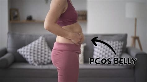 What Does A PCOS Belly Look Like: Effective Strategies for Reducing It - Fischer Institute