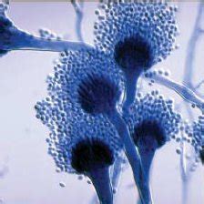 Light microscopy of Aspergillus | Download Scientific Diagram