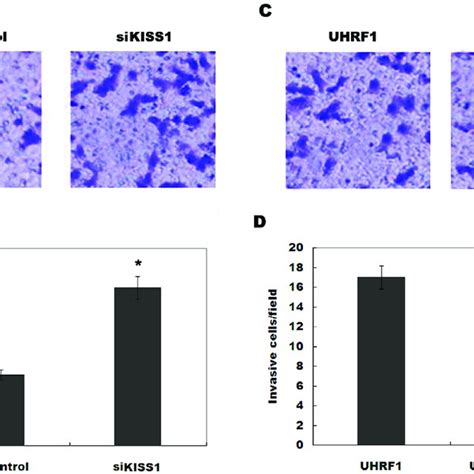 Uhrf Increases Bladder Cancer Cell Invasion By Inhibiting Kiss A