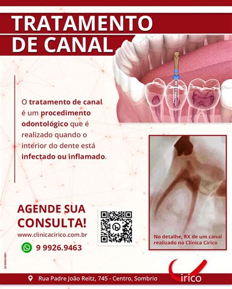 Clínica Cirico Tratamento de Canal Cirico Odontologia