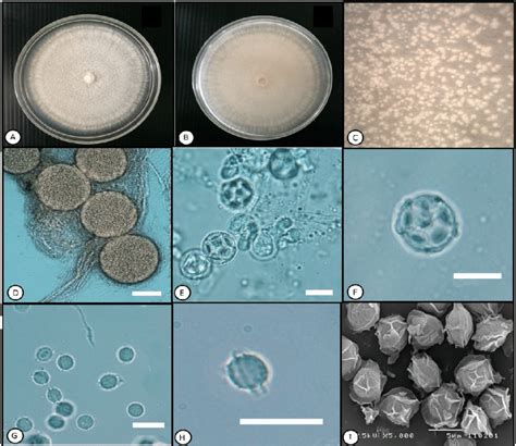 Morphological Features Of Neosartorya Hiratsukae A B Colony Grown On