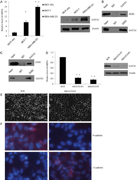 Figure 1 From GATA 1 Promotes Tumorigenesis And Metastasis In Breast