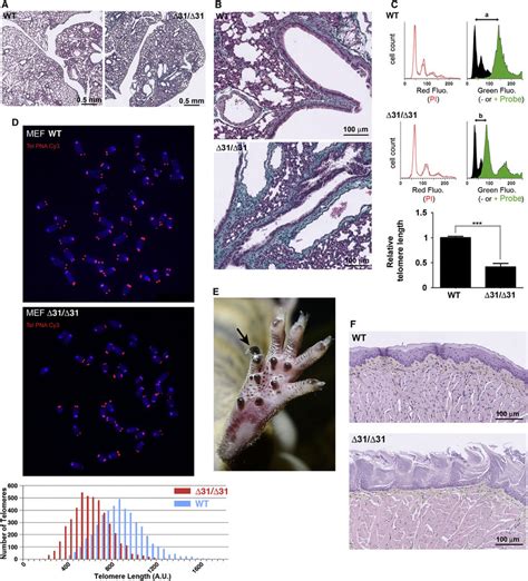 P53 D31d31 Mice Exhibit Features Specific To Dc A And B Pulmonary