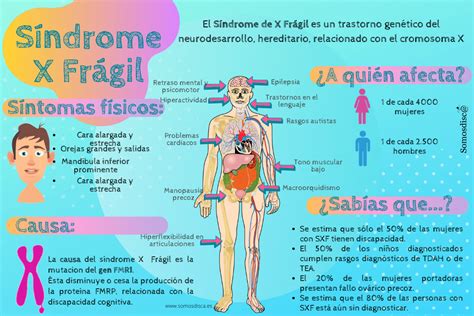 Sintomas De Síndrome Do X Frágil ZULEDU