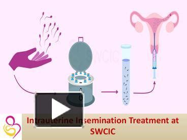 Ppt Iui Intrauterine Insemination Swcic Is Leading Ivf Center In