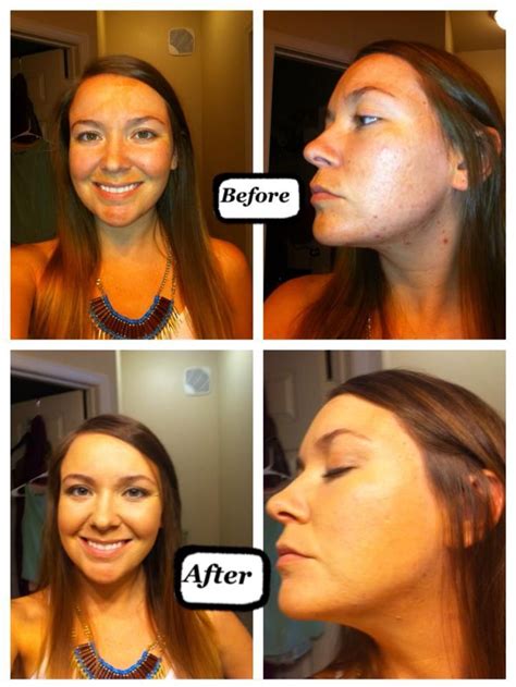 Michelle Winkler Before And After Dinair Https Airbrushmakeup