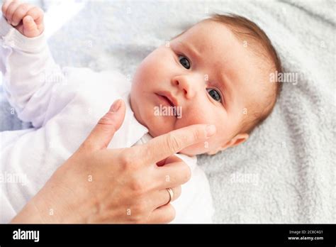 Baby With Atopic Dermatitis Getting Cream Put Care And Prevention Of