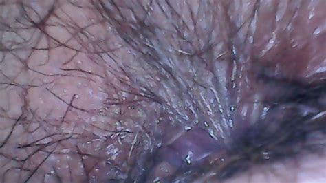 Hairy Ass Exploration With Endoscope And Farts 4K Avi Nicoletta Embassi Clips4Sale