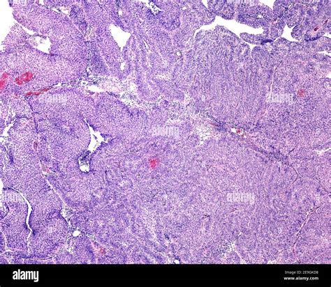 Urinary Bladder Light Micrograph Hi Res Stock Photography And Images