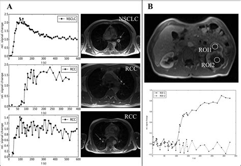 Representative Examples Of Dce Mri Of Patients Benefitting From