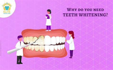 Why Do You Need Teeth Whitening Elite Dental Care