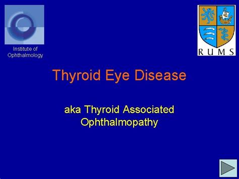 Institute Of Ophthalmology Thyroid Eye Disease Aka Thyroid