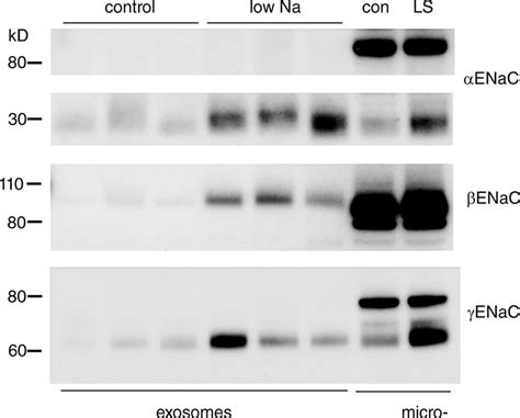 Enac Protein In Urinary Exosomes Exosomes Were Sedimented From The