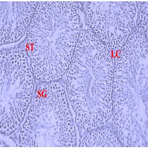 Testes Section Of Normal Control Rat Showing Cross Section Of