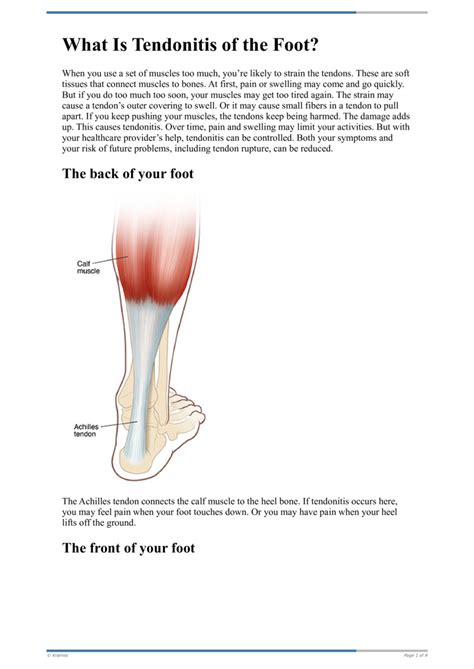 Text What Is Tendonitis Of The Foot Healthclips Online