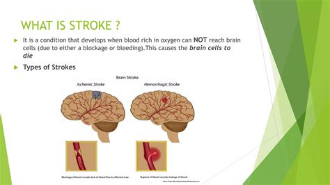 Cerebrovascular Accident Cva Stroke Ppt