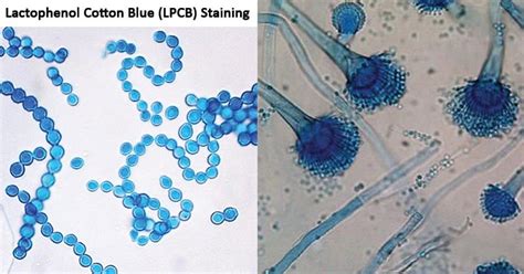 Lactophenol Cotton Blue LPCB Staining Microbe Notes