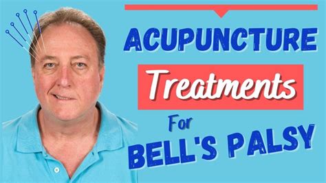 The Power Of Acupuncture In Treating Bells Palsy