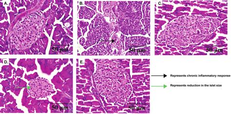 Histopathology Of The Pancreatic Tissue Stained With Hematoxylin And Download Scientific