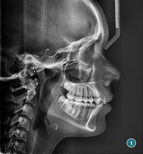 Telerradiograf A De Cr Neo Lateral O Frontal Radiolog A Dental Las