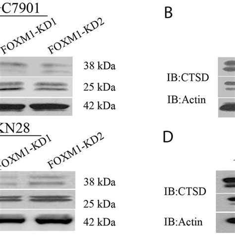 Cath D Expression In FOXM1 Knockdown Or Overexpressing SGC7901 And