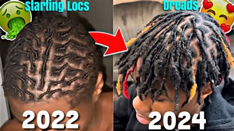 My Dreadlock Journey I Year Transformation Crazy Growth Youtube