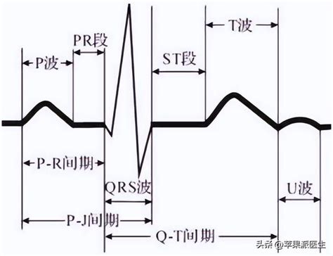 心电图判读（1）：基础知识 知乎