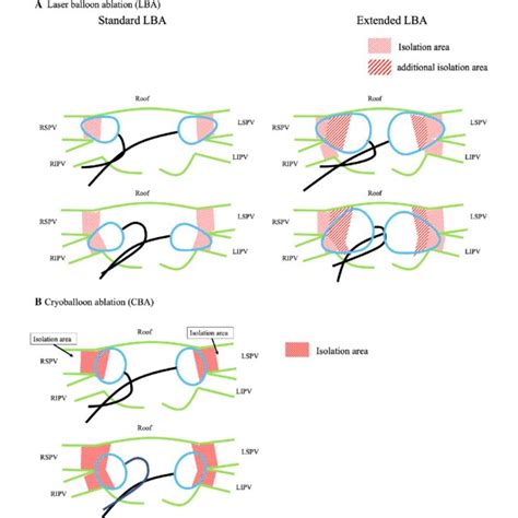 Schematic Diagrams Showing The Isolated Antral Surface Area Produced By