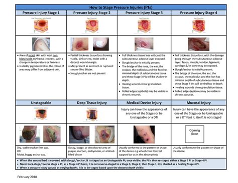 Wound Assessment PRESSURE INJURY CLASSIFICATION STAGE 1:, 42% OFF