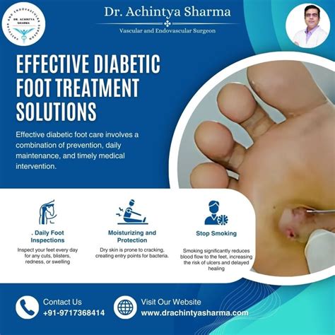 "Diabetic Foot Treatment | Heal Safely and Effectively Now"