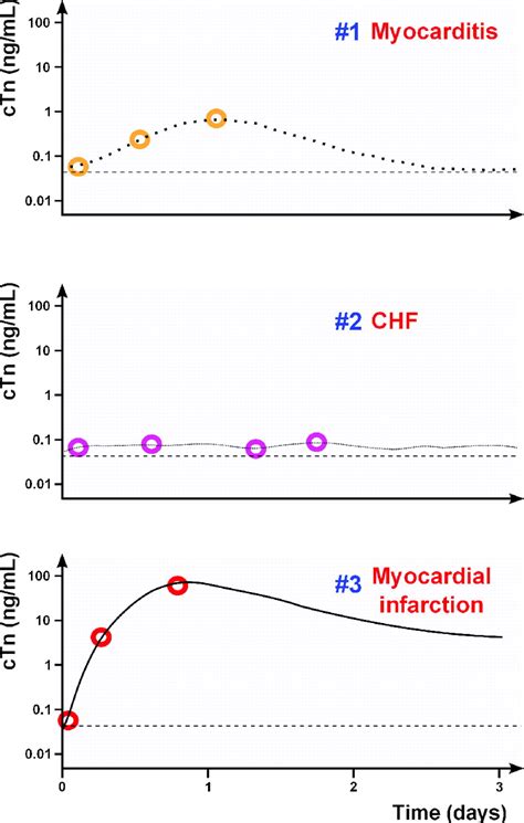 How To Interpret Elevated Cardiac Troponin Levels Circulation