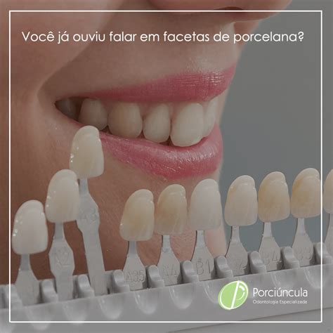 Você já ouviu falar em facetas de porcelana Porciúncula Odontologia