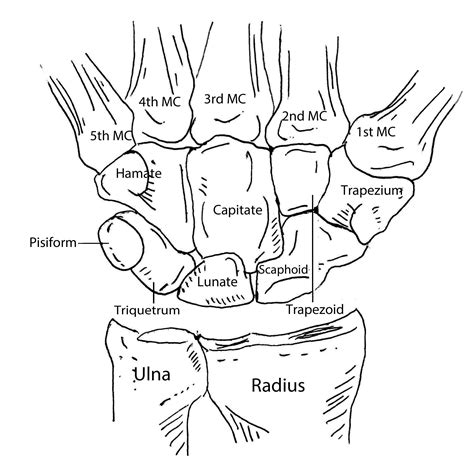 Diagram Of The Bones Of The Hand And Arm