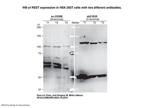 Wb Of Rest Expression In Hek 293t Cells With Two Different Antibodies