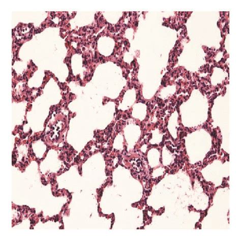 Histopathological Analysis Of Lung Tissues In The S Group A C Group