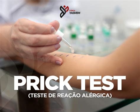 Prick Test Clínica Yasmim Anápolis