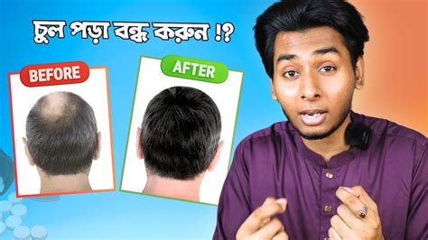 How To Stop Hair Fall And Regrow Hair চুল পড়া বন্ধের ঘরোয়া উপায় কি