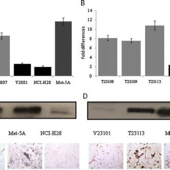 Expression Of Tgfbi Mrna And Protein In Tgfbi Transfected Empty Vector