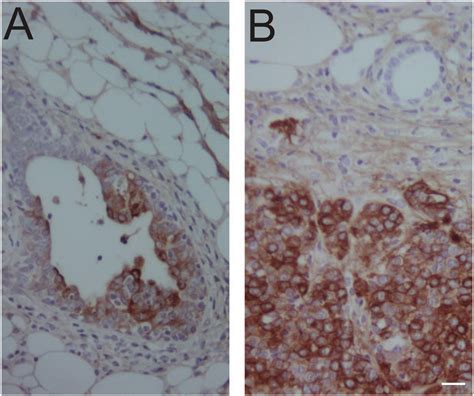 In Vivo Gene Delivery Into Mouse Mammary Epithelial Cells Through